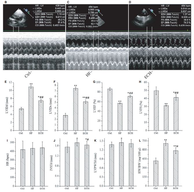 FIGURE 2 Cardiac hypertrophy of HF rats induced by ISO is relieved and heart function is significantly improved by ECH treated. 