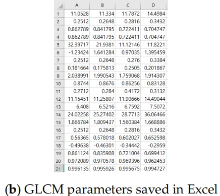 Table 3   shows the parameters that can be extracted when calculating the GLCM using an ROI image. Table 1 shows the variables and notation used to compute texture features that are the parameters of the GLCM.