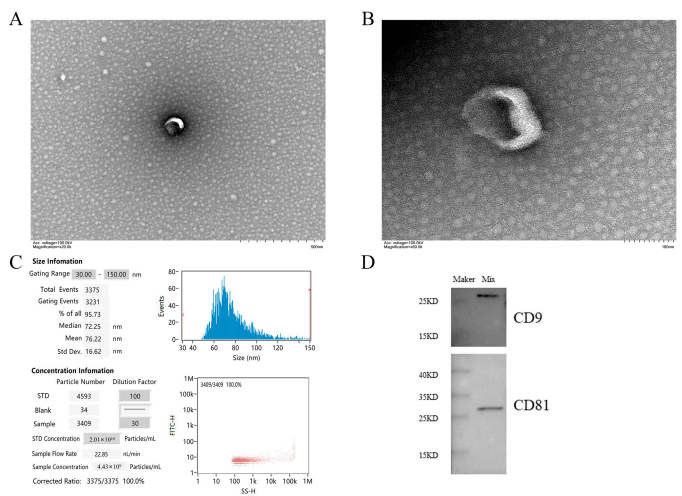 Figure 1. Main characteristics of serum exosomes. (A, B) show the morphological characteristics of vesicles by TEM. Scale bars are 500 nm and 100 nm, respectively. (C) NTA shows the diameter and concentration of most vesicles. (D) Western blot showed the presence of exosome markers CD81 and CD9 in serum exosomes. Note: Mix in WB results is the sample mixed suspension isolated by the exoEasy Maxi kit